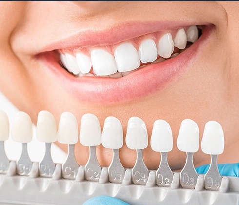 Smile compared to metal free dental restoration shade chart