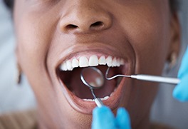 a woman receiving a dental exam