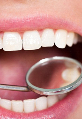 Close up of dental mirror examining a patient’s teeth