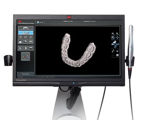 True definition tooth scanner images