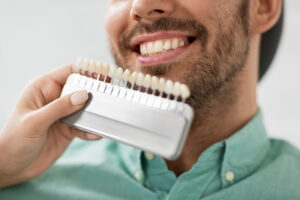 a dentist holding a shade chart up to a man's teeth 
