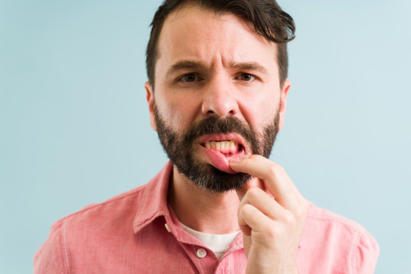 man suffering from gum disease