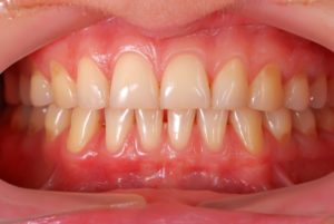 A closeup of someone’s mouth.