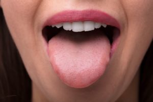 Woman sticking out her tongue at visit with the dentist