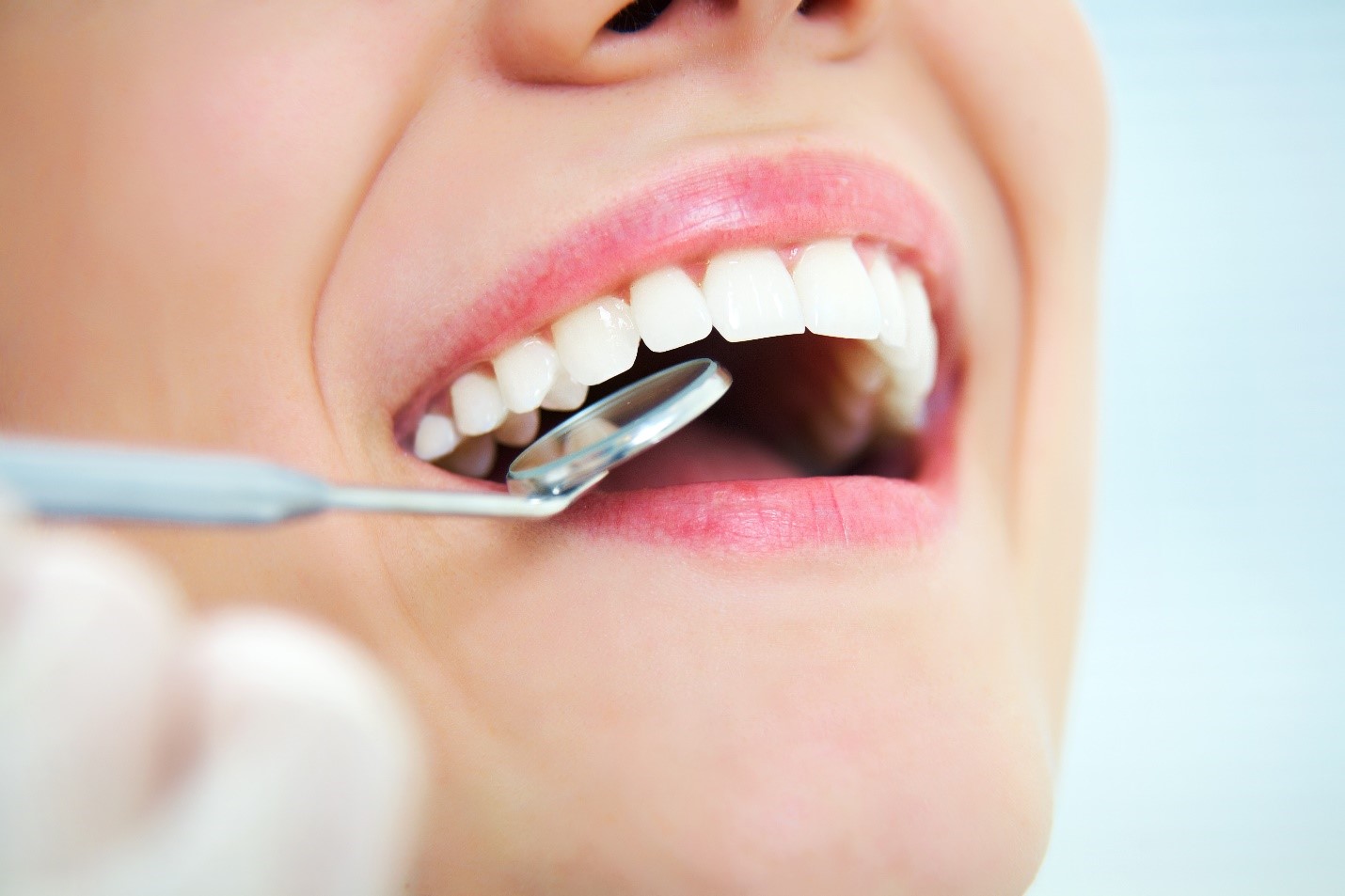 6 Reasons to Visit Your Dentist Regularly