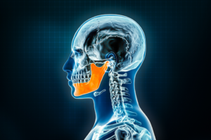 a computer illustration showing the head and neck and highlighting the jawbone